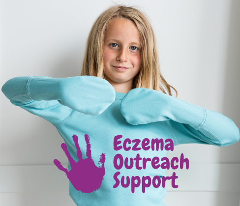 Eczema Outreach Support: Nurturing Thriving Lives