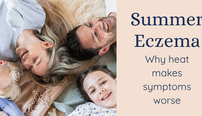 eczema in summer guide